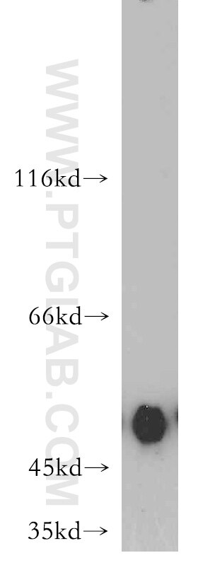 Western Blot (WB) analysis of A375 cells using MAF Polyclonal antibody (55013-1-AP)