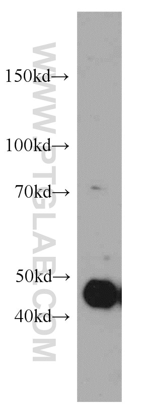 Western Blot (WB) analysis of A431 cells using MAF Polyclonal antibody (55013-1-AP)