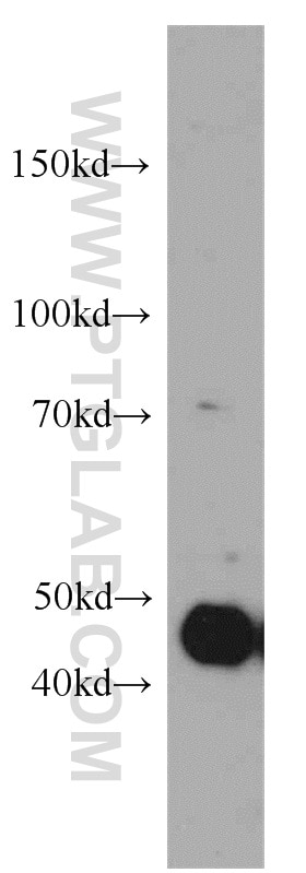 WB analysis of A431 using 55013-1-AP