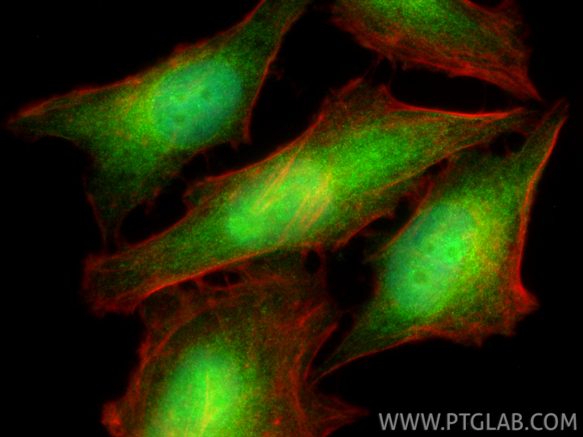 IF Staining of HeLa using 11619-1-AP Immunofluorescence (IF) / fluorescent staining of HeLa cells using MAF1 Polyclonal antibody (11619-1-AP)