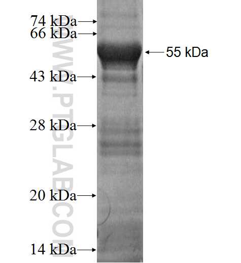 MAF1 fusion protein Ag2198 SDS-PAGE