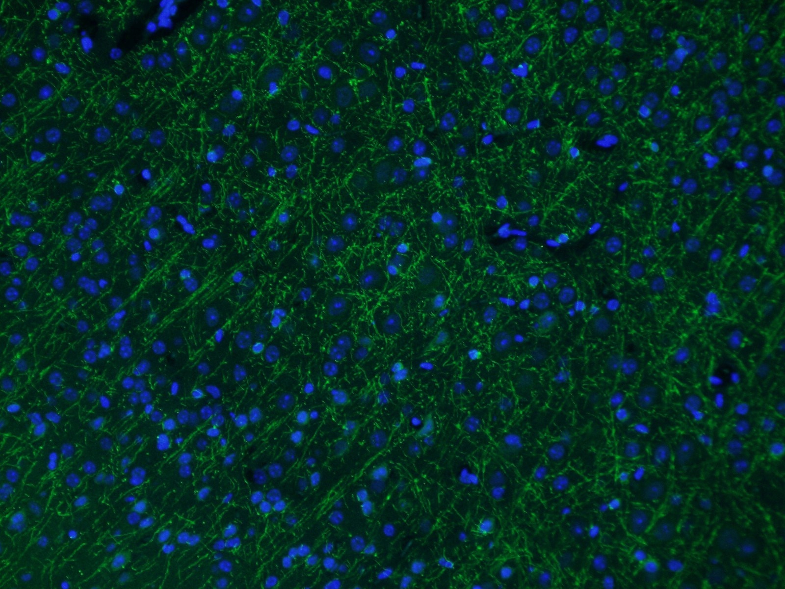 IF Staining of mouse brain using 14386-1-AP