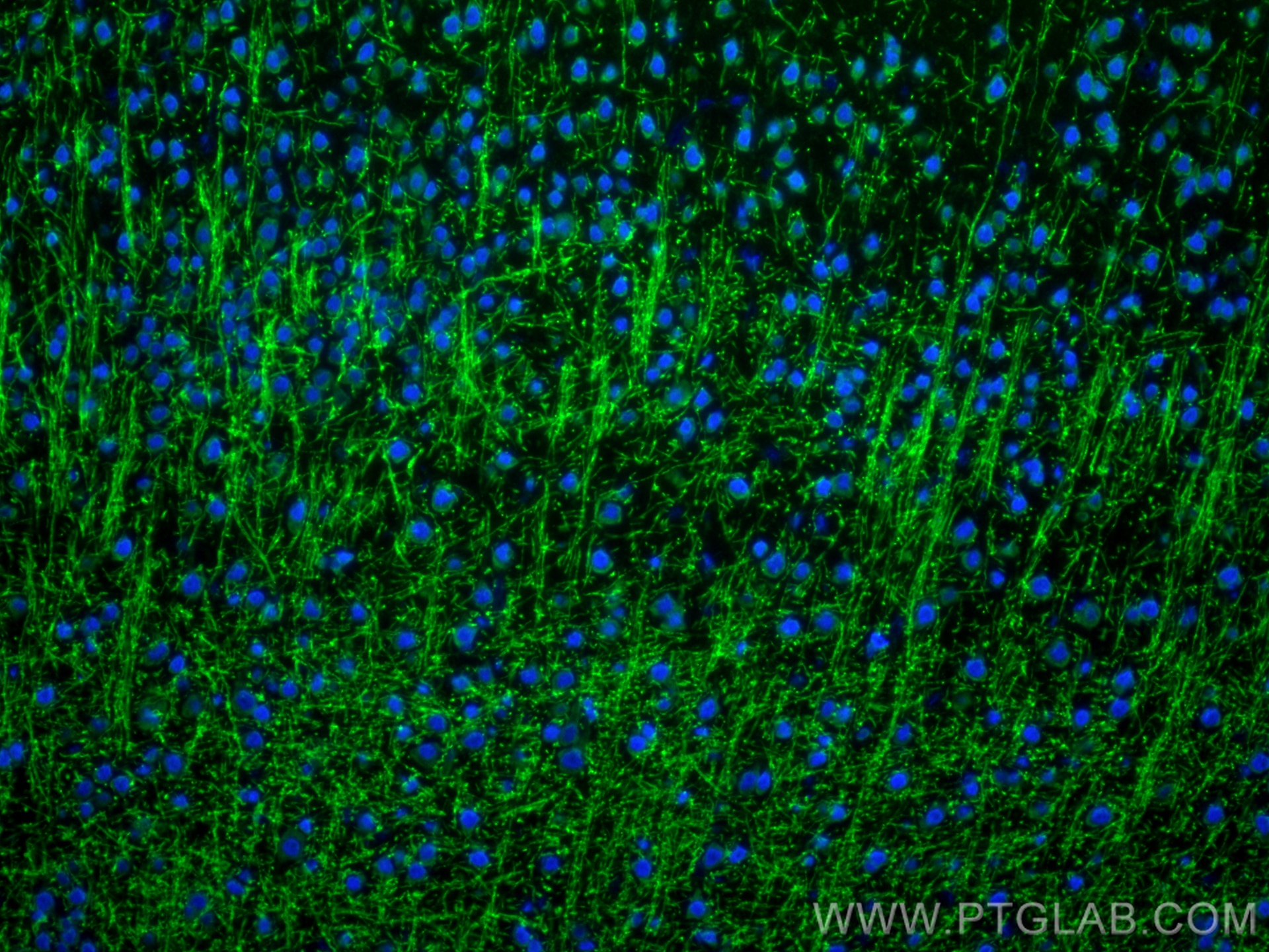 Immunofluorescence (IF) / fluorescent staining of mouse brain tissue using MAG Polyclonal antibody (14386-1-AP)