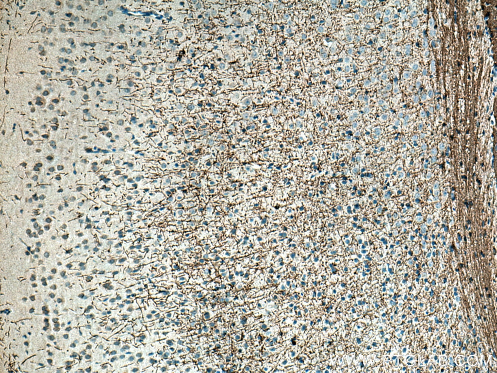 Immunohistochemistry (IHC) staining of mouse brain tissue using MAG Polyclonal antibody (14386-1-AP)