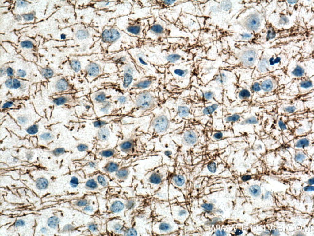 Immunohistochemistry (IHC) staining of mouse brain tissue using MAG Polyclonal antibody (14386-1-AP)
