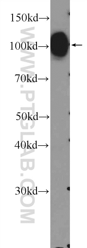 Western Blot (WB) analysis of mouse spinal cord tissue using MAG Polyclonal antibody (14386-1-AP)