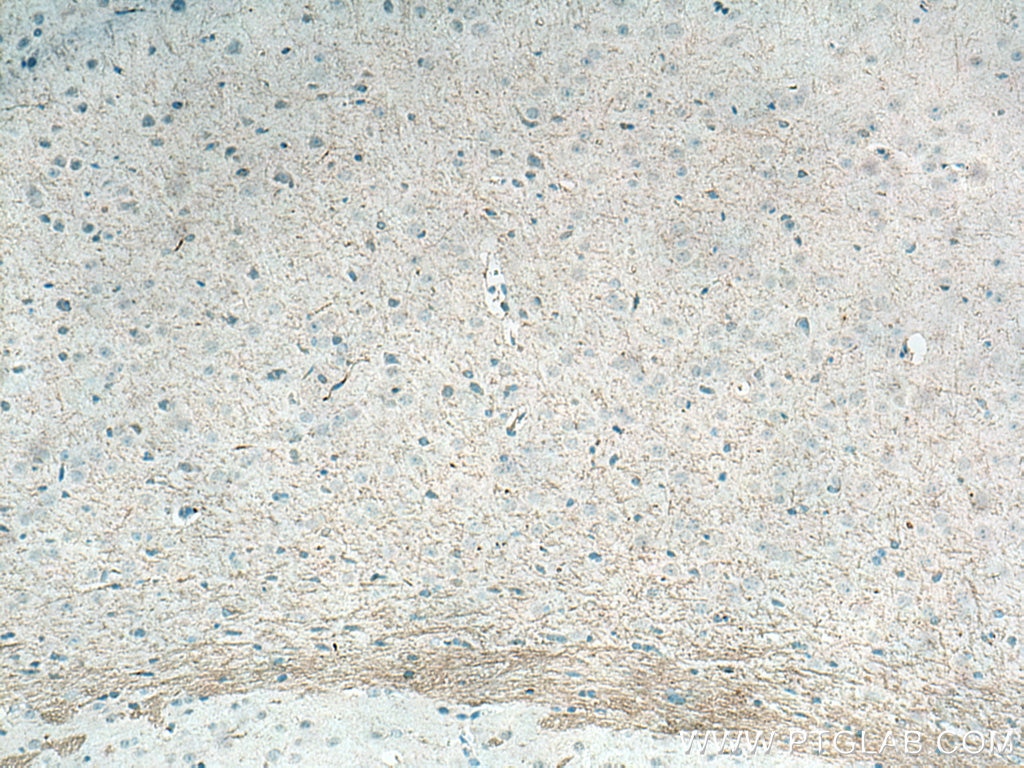 Immunohistochemistry (IHC) staining of mouse brain tissue using MAG Monoclonal antibody (66709-1-Ig)