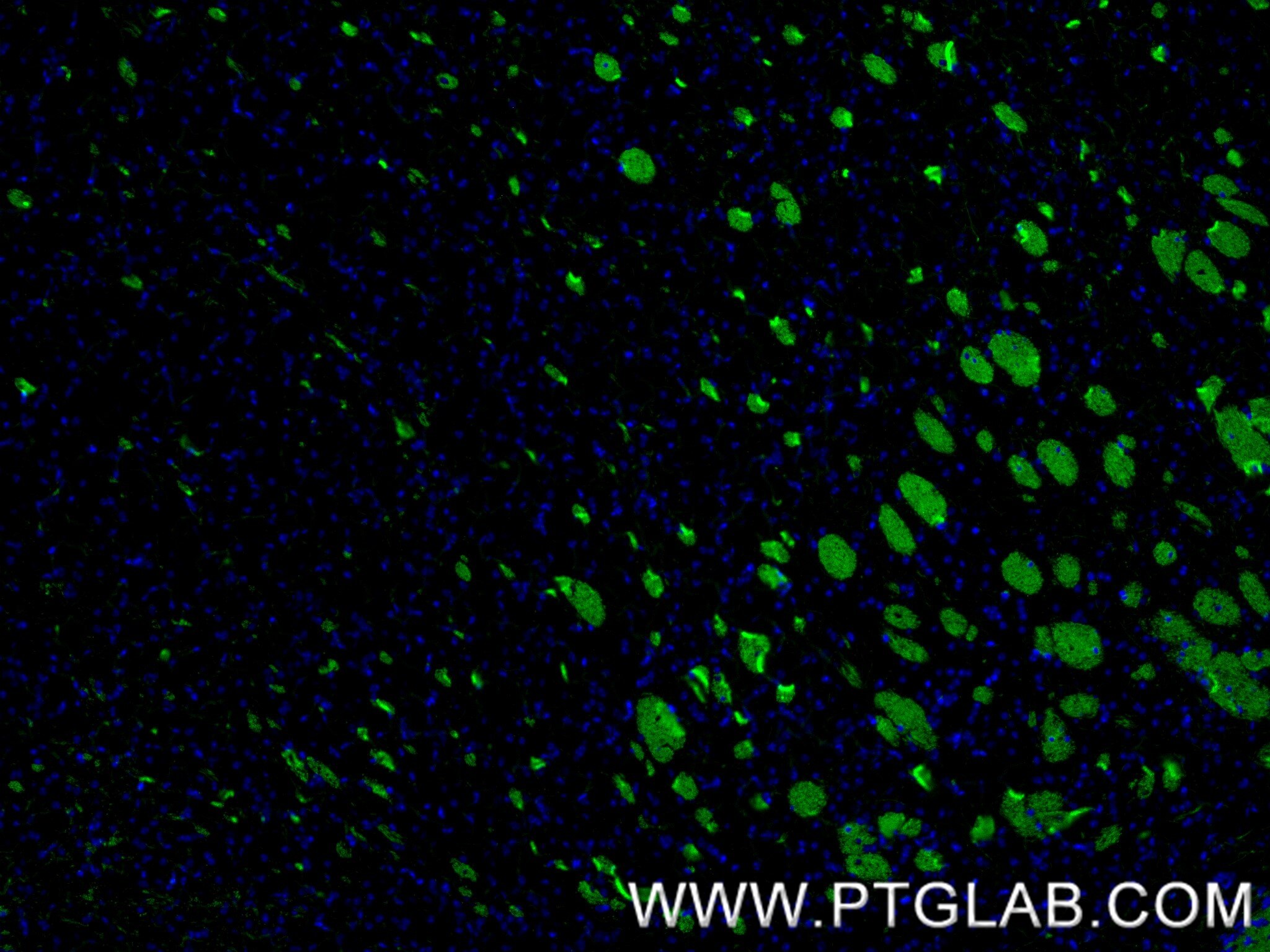 Immunofluorescence (IF) / fluorescent staining of mouse brain tissue using MAG Recombinant monoclonal antibody (86097-1-RR)