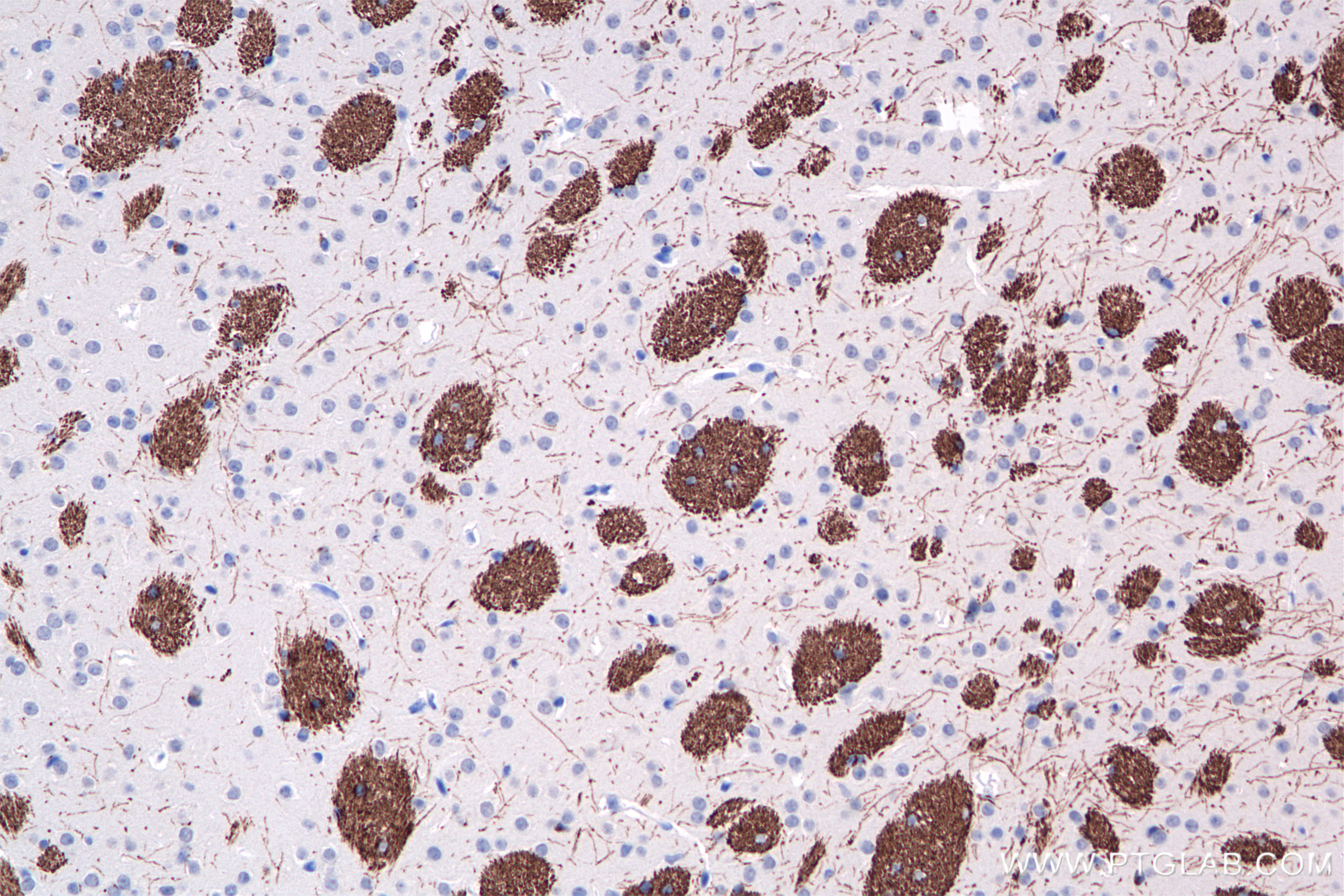 Immunohistochemistry (IHC) staining of mouse brain tissue using MAG Recombinant antibody (86097-1-RR)