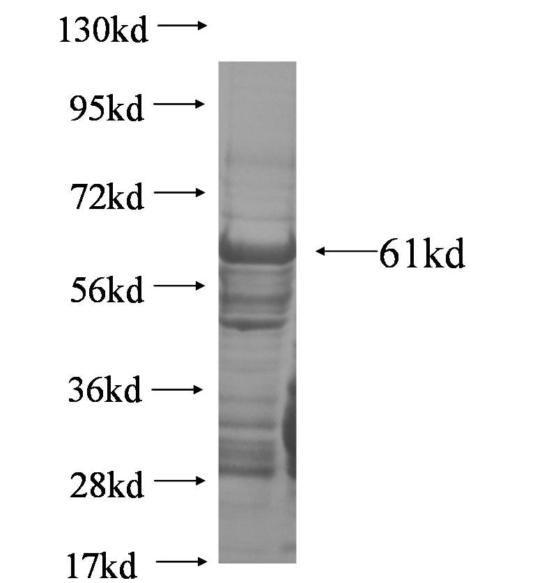 MAG fusion protein Ag5845 SDS-PAGE