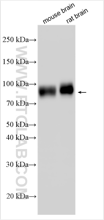 Western Blot (WB) analysis of various lysates using MAG/Siglec-4a Polyclonal antibody (33295-1-AP)