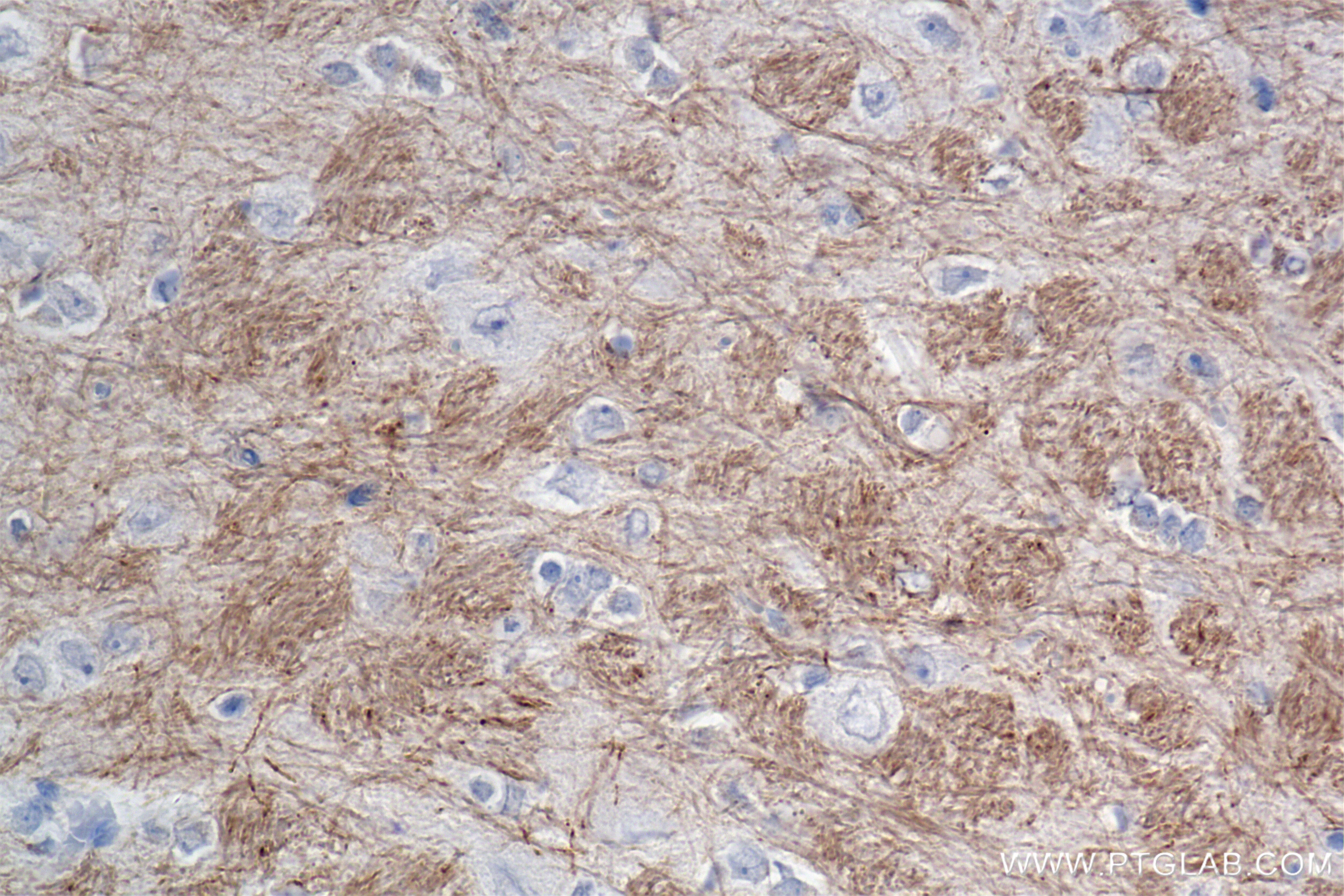 Immunohistochemistry (IHC) staining of rat brain tissue using MAG/Siglec-4a Recombinant antibody (86073-2-RR)