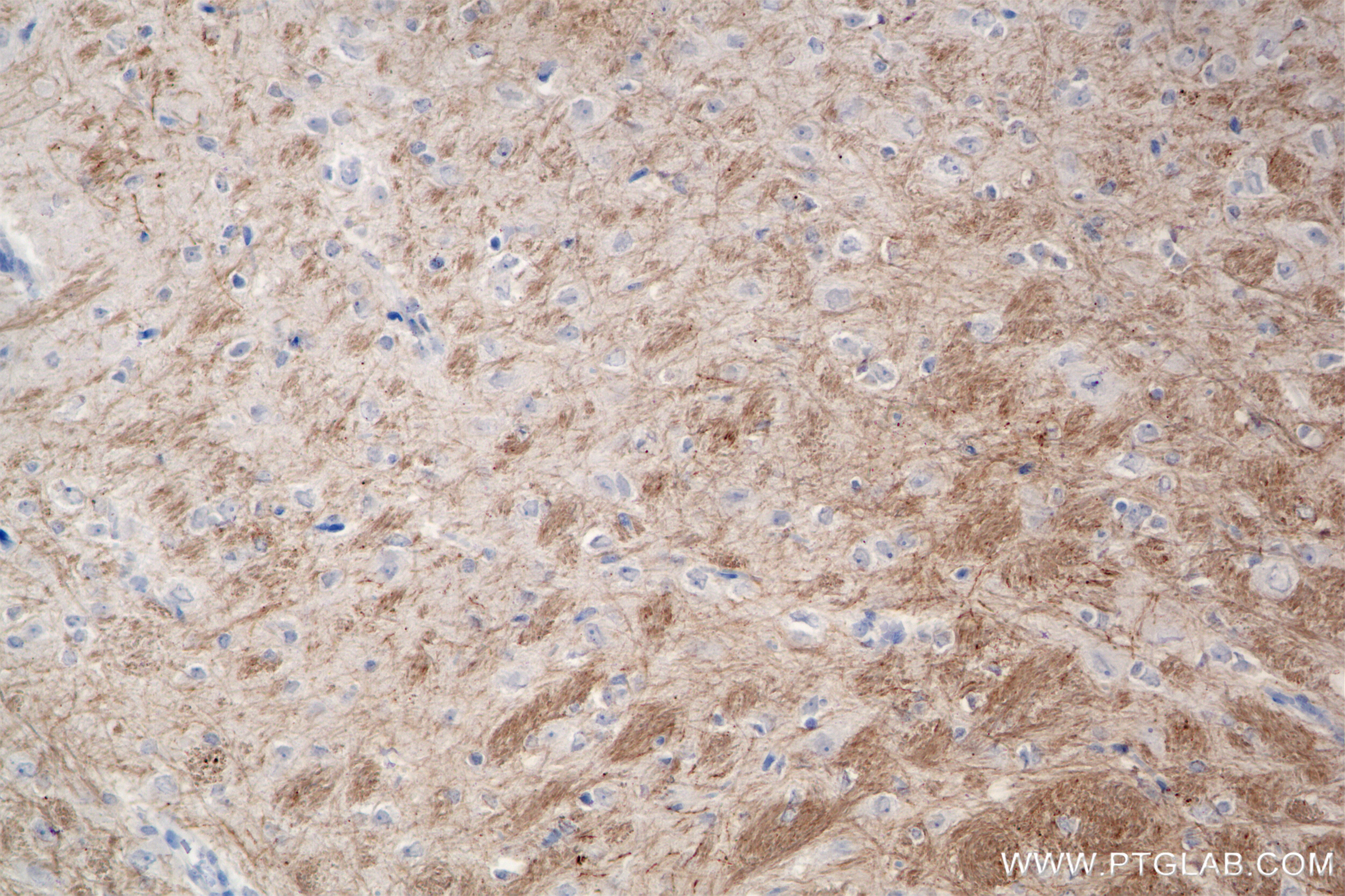 Immunohistochemistry (IHC) staining of rat brain tissue using MAG/Siglec-4a Recombinant antibody (86073-2-RR)