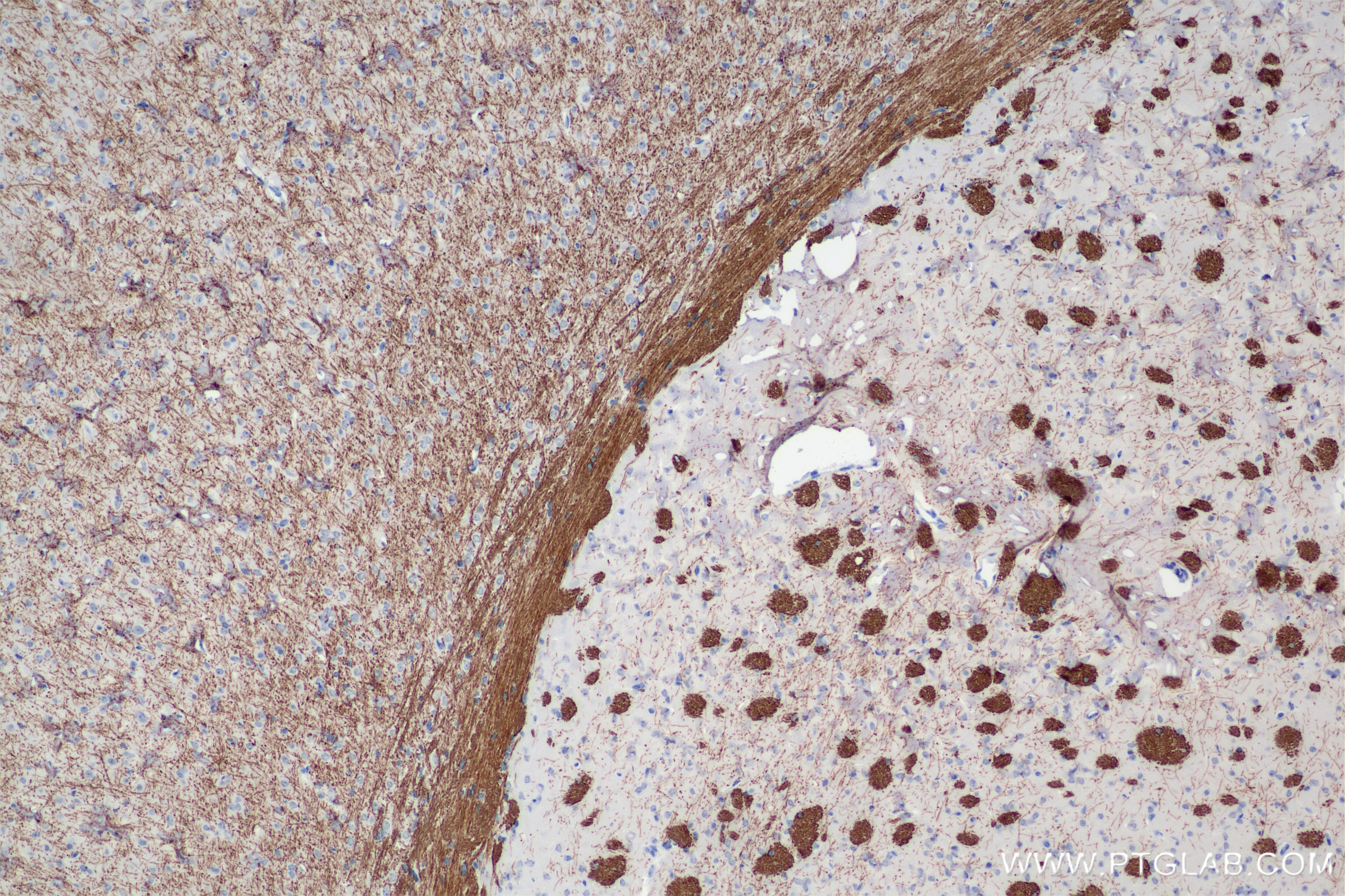 Immunohistochemistry (IHC) staining of mouse brain tissue using MAG/Siglec-4a Recombinant antibody (86073-3-RR)