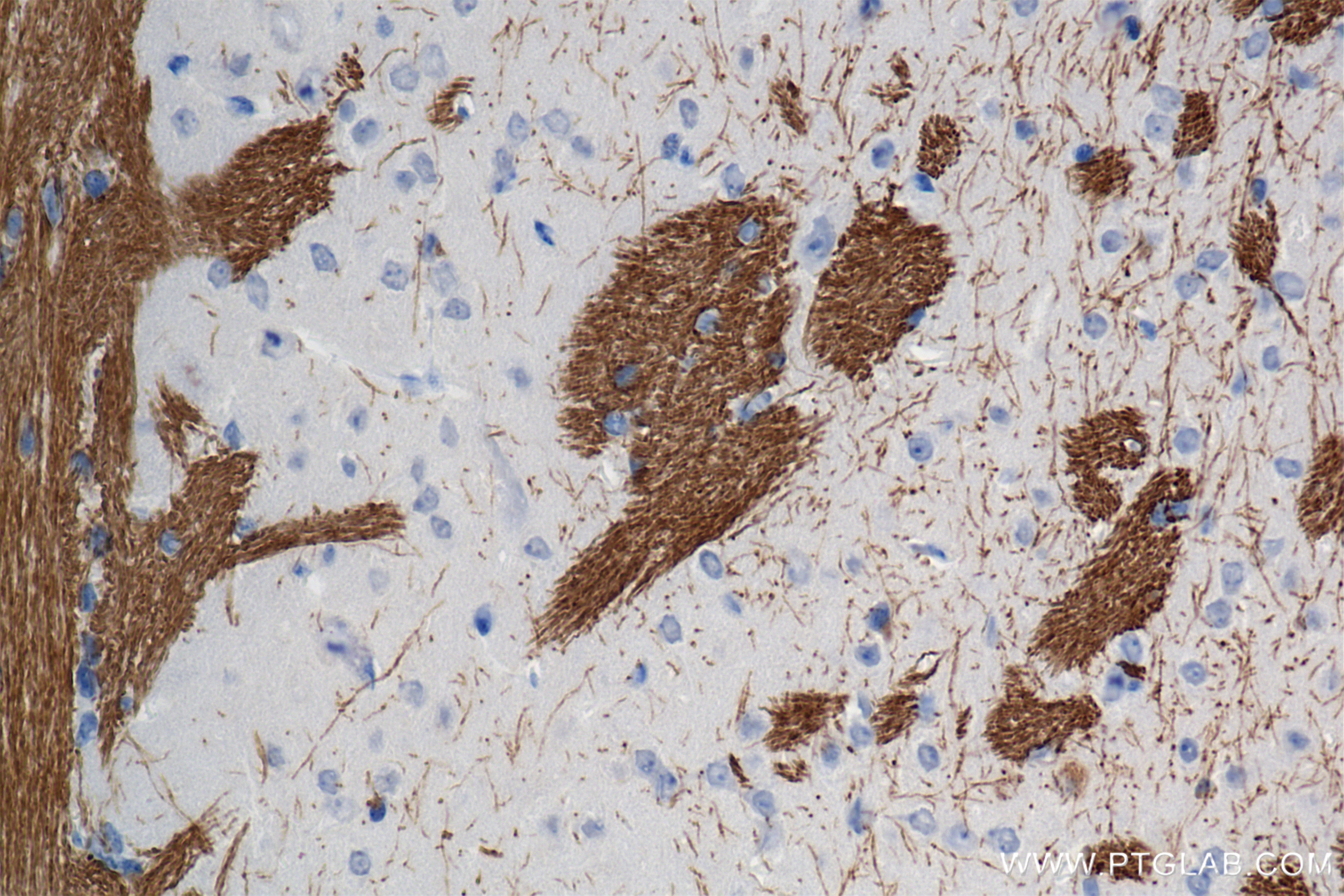 Immunohistochemistry (IHC) staining of mouse brain tissue using MAG/Siglec-4a Recombinant antibody (86073-3-RR)