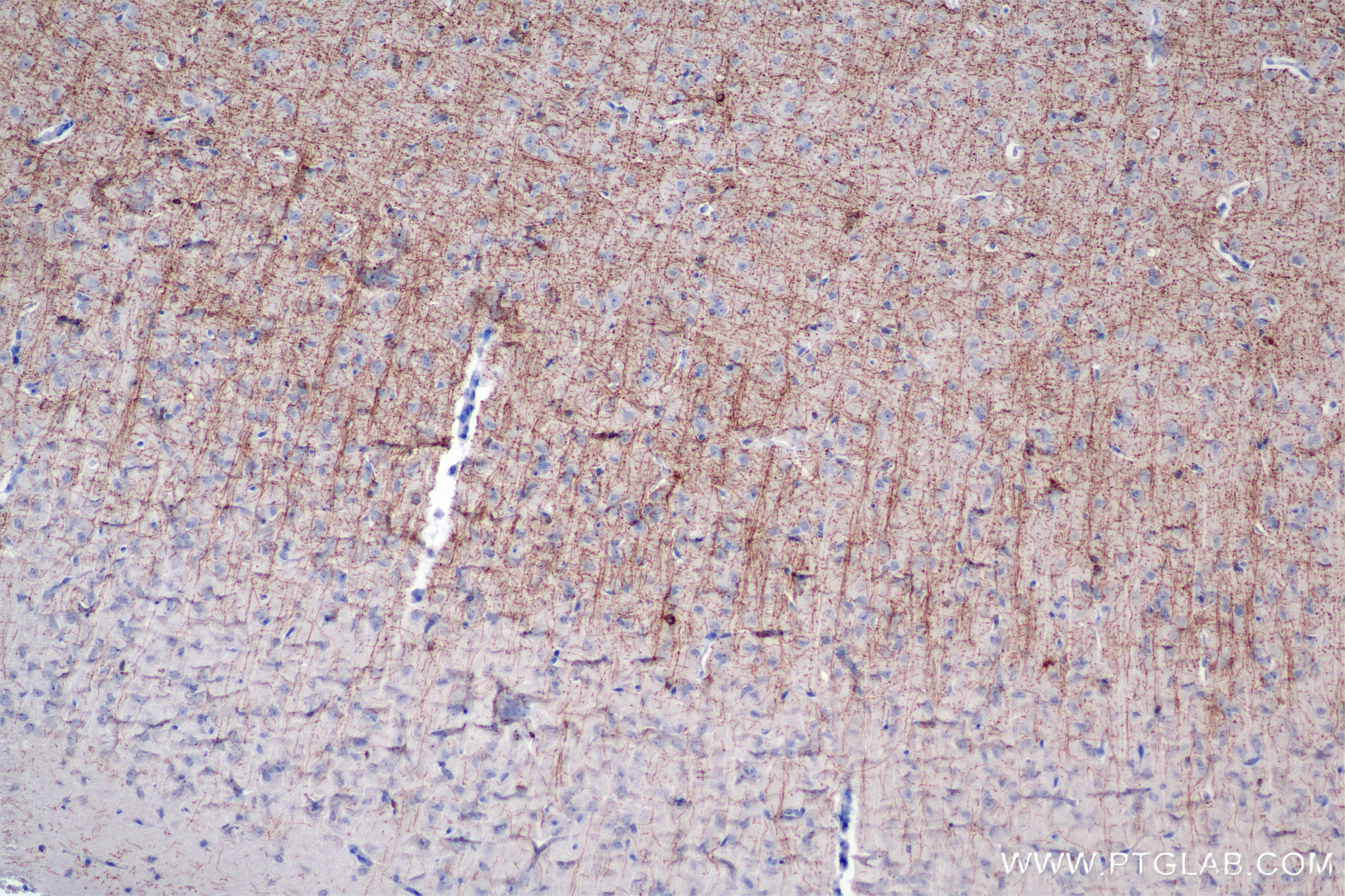 Immunohistochemistry (IHC) staining of rat brain tissue using MAG/Siglec-4a Recombinant antibody (86073-3-RR)