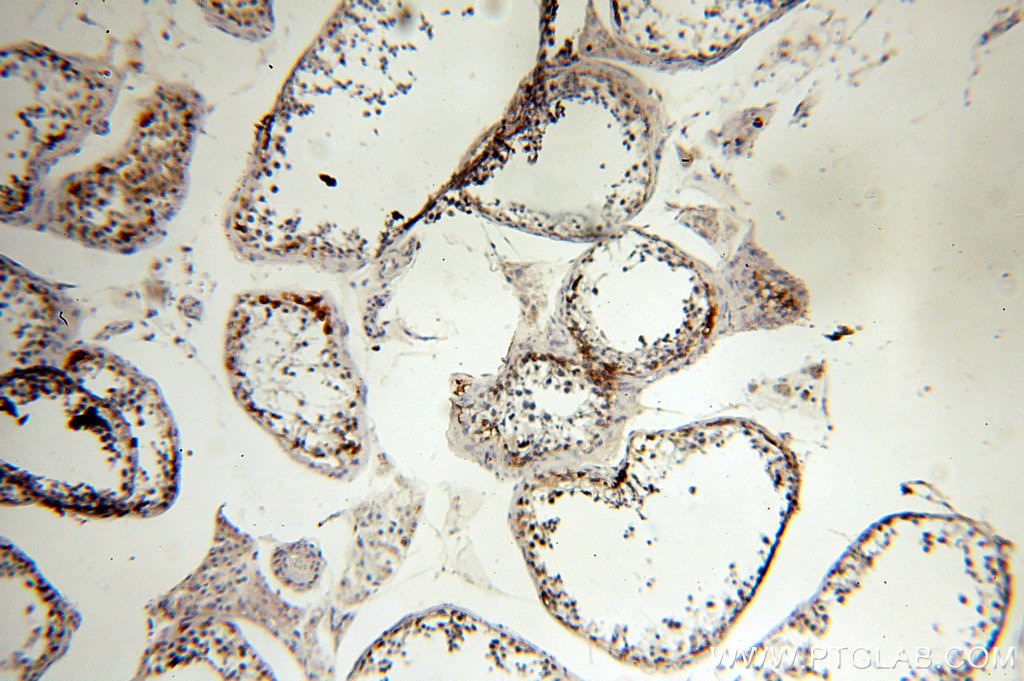 Immunohistochemistry (IHC) staining of human testis tissue using MAGEA1 Polyclonal antibody (12233-1-AP)