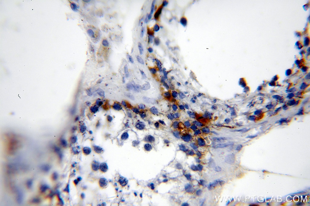 Immunohistochemistry (IHC) staining of human testis tissue using MAGEA1 Polyclonal antibody (12233-1-AP)