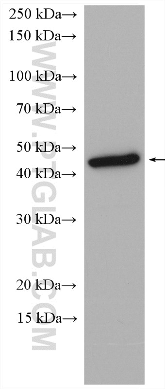 Western Blot (WB) analysis of A375 cells using MAGEA1 Polyclonal antibody (12233-1-AP)