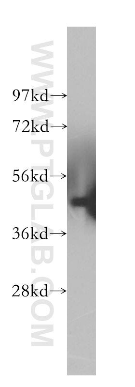 MAGEA1 Polyclonal antibody