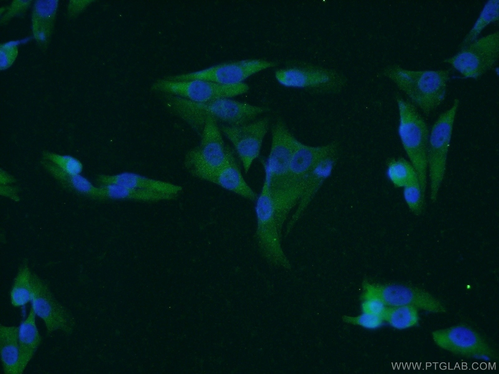 Immunofluorescence (IF) / fluorescent staining of A375 cells using MAGEA1 Polyclonal antibody (55105-1-AP)