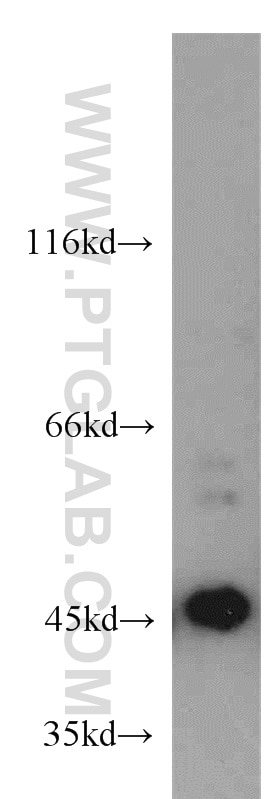 Western Blot (WB) analysis of A375 cells using MAGEA1 Polyclonal antibody (55105-1-AP)