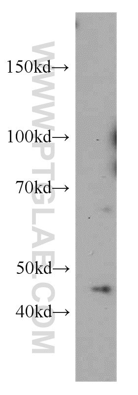 Western Blot (WB) analysis of MCF-7 cells using MAGEA1 Polyclonal antibody (55105-1-AP)