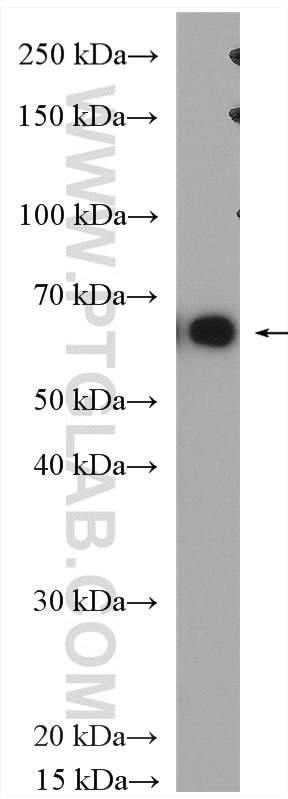 Western Blot (WB) analysis of A375 cells using MAGEA10 Polyclonal antibody (15295-1-AP)
