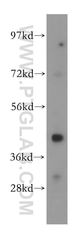 Western Blot (WB) analysis of Jurkat cells using MAGEA10 Polyclonal antibody (15295-1-AP)