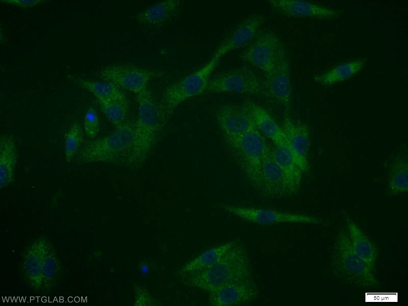 Immunofluorescence (IF) / fluorescent staining of A375 cells using MAGEA11 Polyclonal antibody (15474-1-AP)