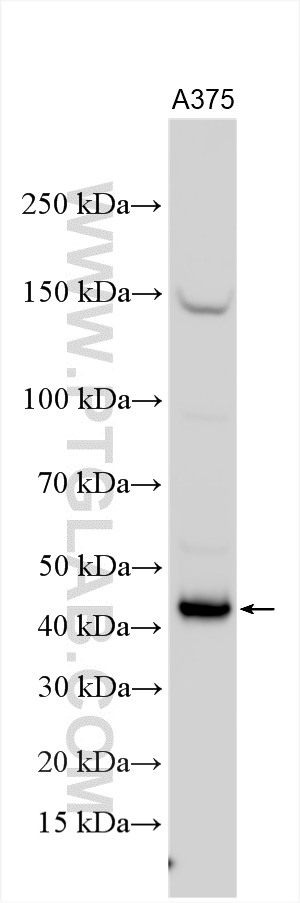 WB analysis using 15474-1-AP (same clone as 15474-1-PBS) Western Blot (WB) analysis of various lysates using MAGEA11 Polyclonal antibody (15474-1-AP)