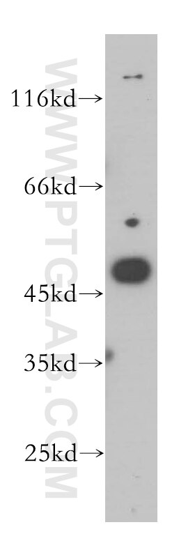 Western Blot (WB) analysis of A375 cells using MAGEA11 Polyclonal antibody (15474-1-AP)