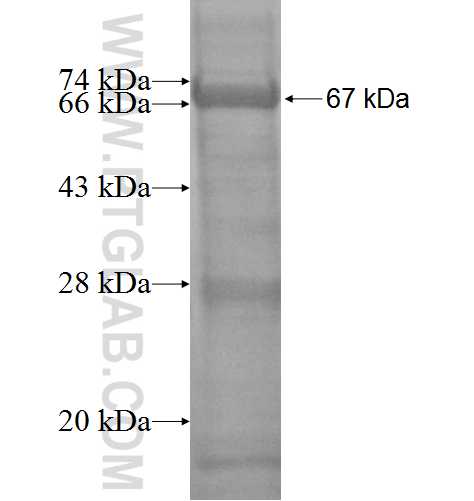 MAGEA2 fusion protein Ag3141 SDS-PAGE