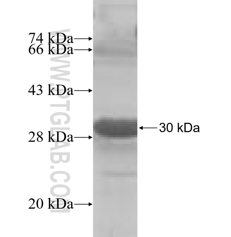 MAGEA2 fusion protein Ag6090 SDS-PAGE