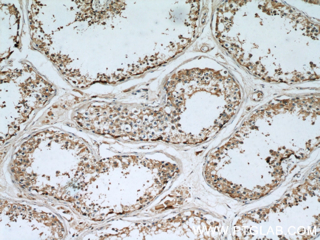 Immunohistochemistry (IHC) staining of human testis tissue using MAGEA3 Monoclonal antibody (60054-1-Ig)