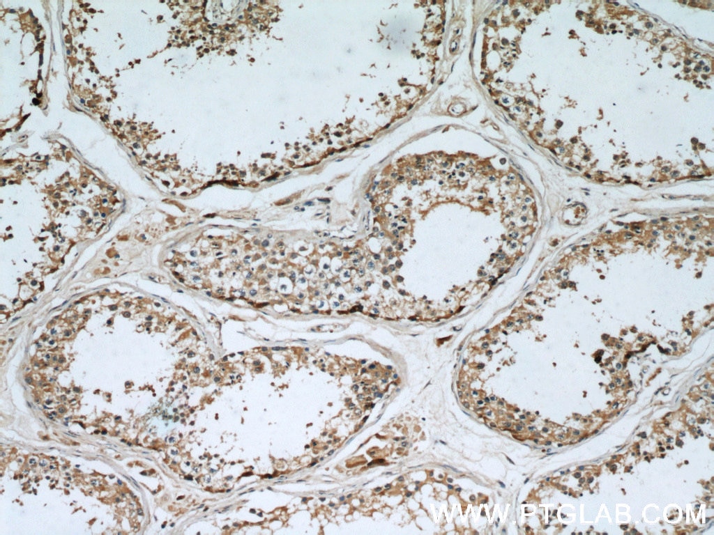 IHC staining of human testis using 60054-1-Ig