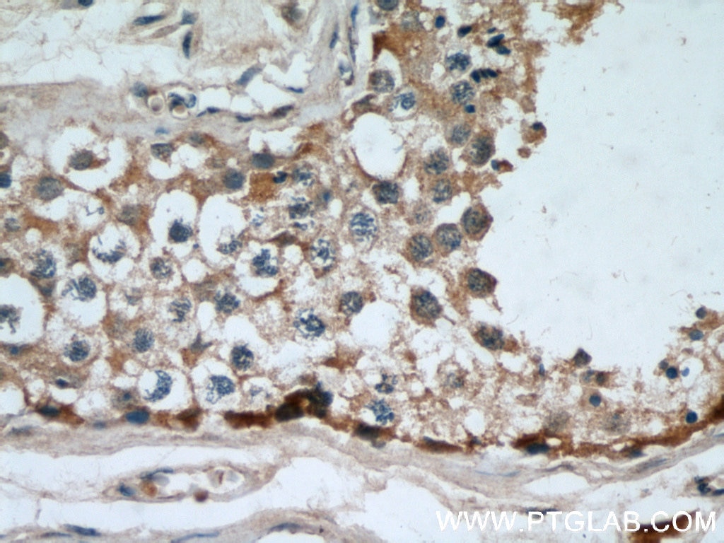 Immunohistochemistry (IHC) staining of human testis tissue using MAGEA3 Monoclonal antibody (60054-1-Ig)