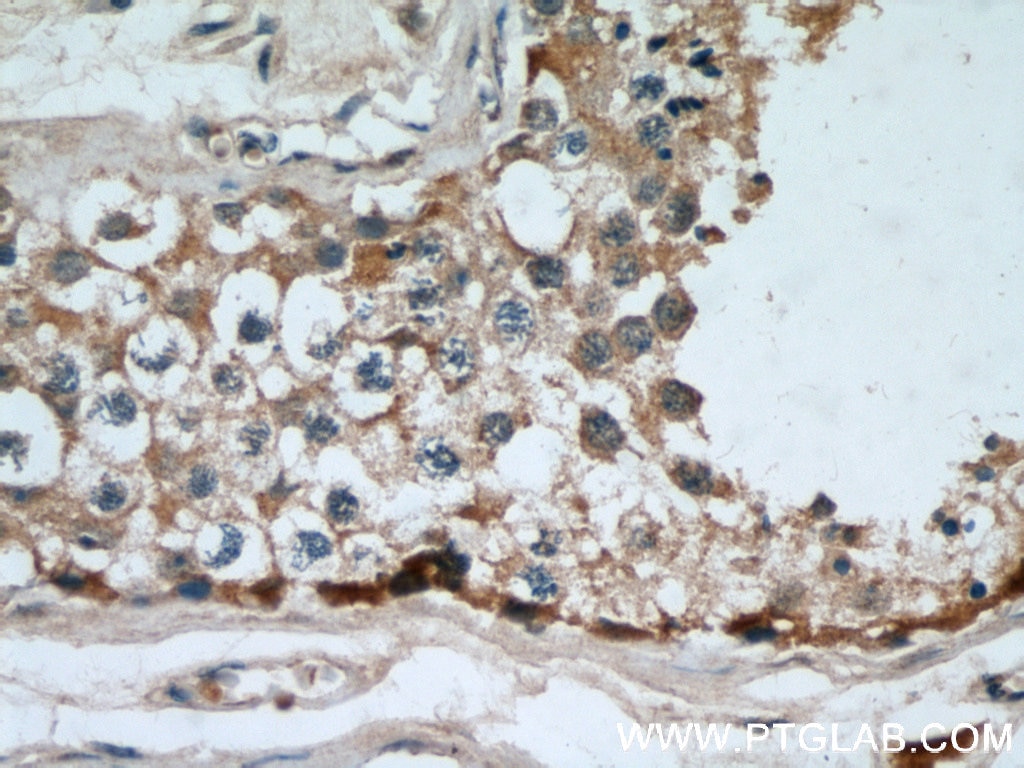 IHC staining of human testis using 60054-1-Ig