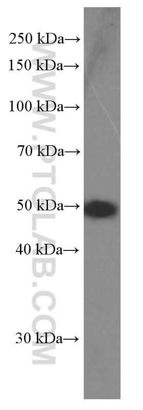 Western Blot (WB) analysis of fetal human brain tissue using MAGEA3 Monoclonal antibody (60054-1-Ig)