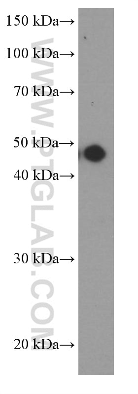 Western Blot (WB) analysis of rat brain tissue using MAGEA3 Monoclonal antibody (60054-1-Ig)