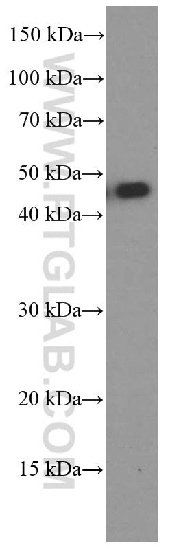 Western Blot (WB) analysis of rat brain tissue using MAGEA3 Monoclonal antibody (60054-1-Ig)