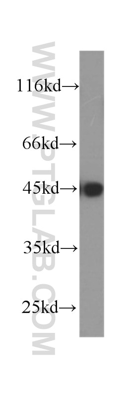 Western Blot (WB) analysis of human testis tissue using MAGEA3 Monoclonal antibody (60054-1-Ig)