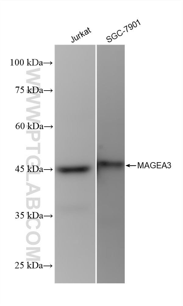 Western Blot (WB) analysis of various lysates using MAGEA3 Recombinant antibody (83480-5-RR)