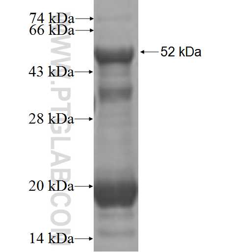 MAGEA3 fusion protein Ag0265 SDS-PAGE