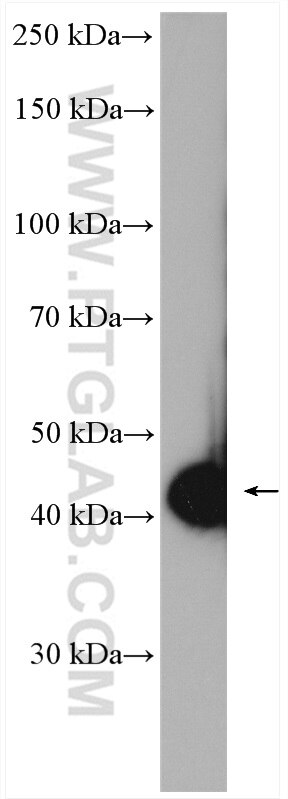 MAGEA4