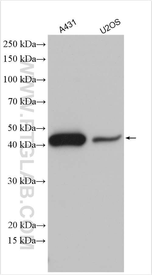 Western Blot (WB) analysis of various lysates using MAGEA4 Polyclonal antibody (12508-1-AP)