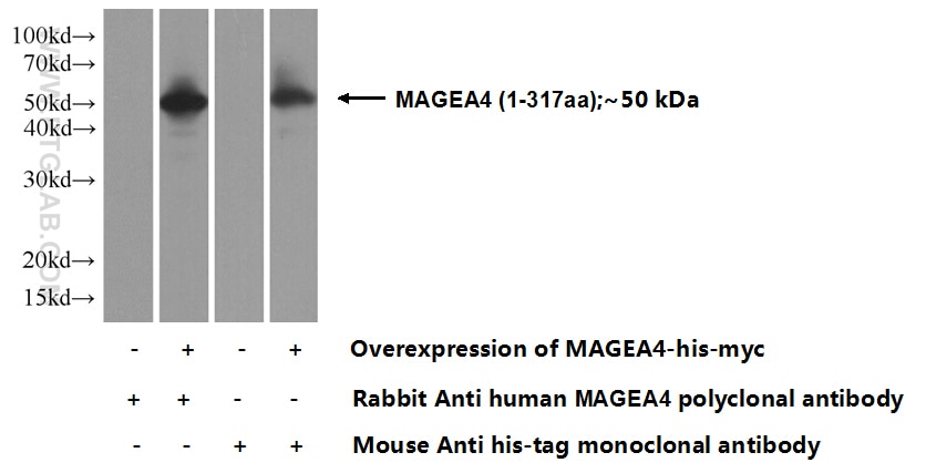 MAGEA4 Polyclonal antibody