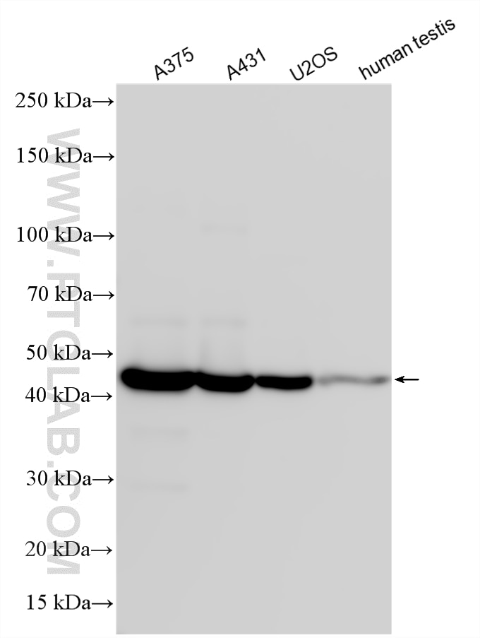 Various lysates were subjected to SDS PAGE followed by western blot with 12508-1-AP (MAGEA4 antibody) at dilution of 1:10000 incubated at room temperature for 1.5 hours. Western Blot (WB) analysis of various lysates using MAGEA4 Polyclonal antibody (12508-1-AP)