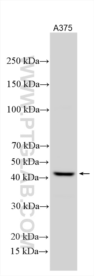Western Blot (WB) analysis of various lysates using MAGEA4 Polyclonal antibody (55109-1-AP)