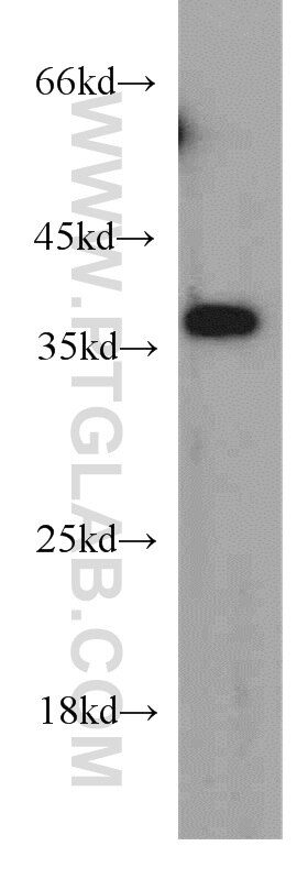 Western Blot (WB) analysis of human placenta tissue using MAGEA4 Polyclonal antibody (55109-1-AP)